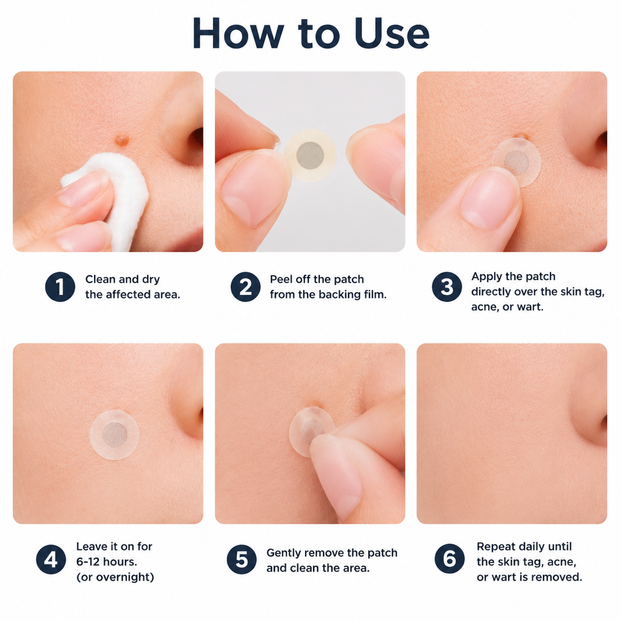 LIMETOW® 2-in-1 Microneedle & Hydrocolloid Patch🍀 | Removes Raised Moles, Acne, Flat Warts, Skin Tags, Milia & Age Spots | No Surgery Needed | Invisible Skin Treatment for Face & Body | 90-Day Money-Back Guarantee