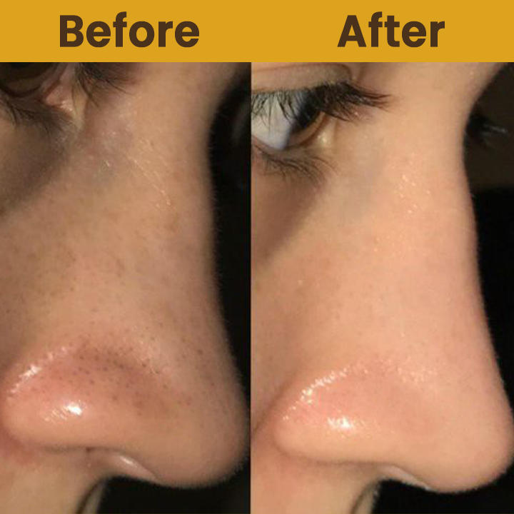 LIMETOW™ Rice Essence Peel-Off Deep Renewal Face Mask