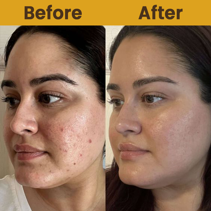 LIMETOW™ Rice Essence Peel-Off Deep Renewal Face Mask