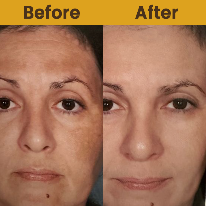 LIMETOW™ Rice Essence Peel-Off Deep Renewal Face Mask