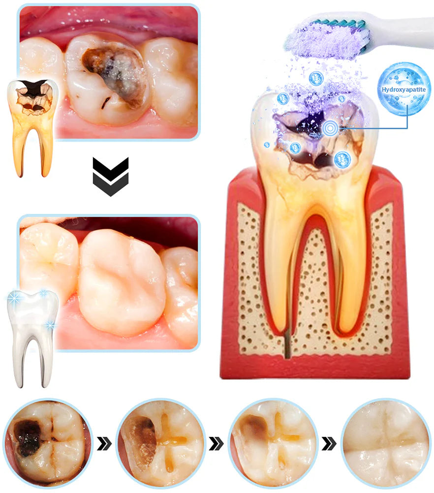 LIMETOW® Teeth Restoration Mineral Powder(CDA recommended)(Flash Sale Don't Miss Out)