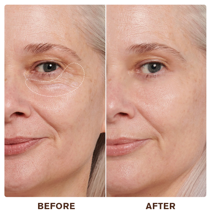 LIMETOW®Instant Eye Cream Tightener