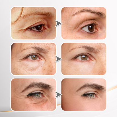 LIMETOW®Instant Eye Cream Tightener