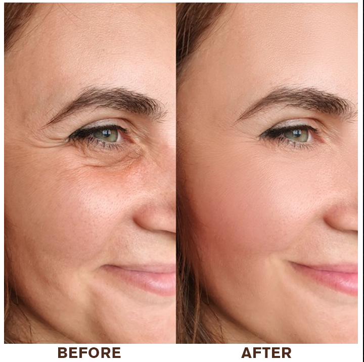 LIMETOW®Instant Eye Cream Tightener