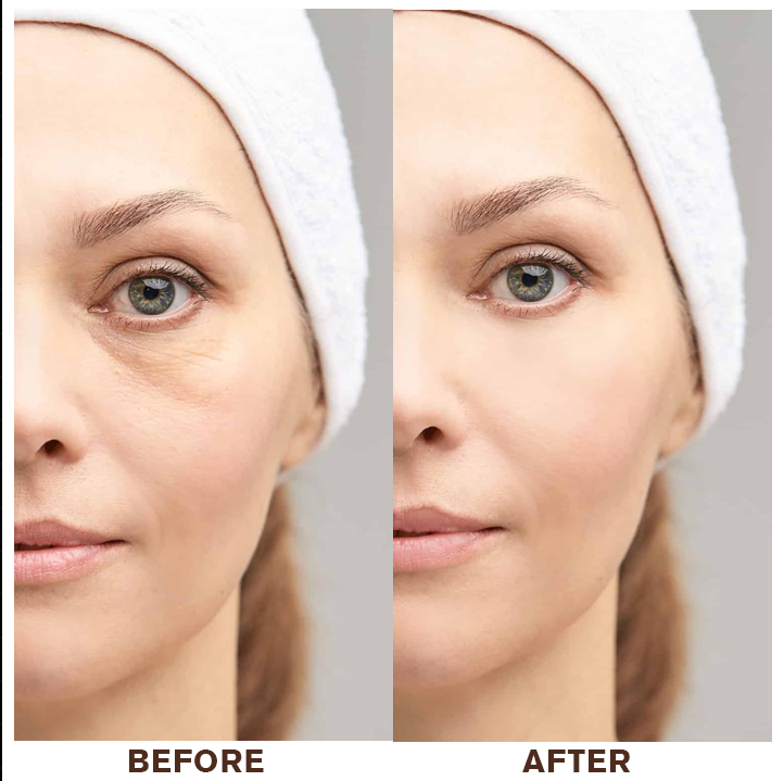 LIMETOW®Instant Eye Cream Tightener