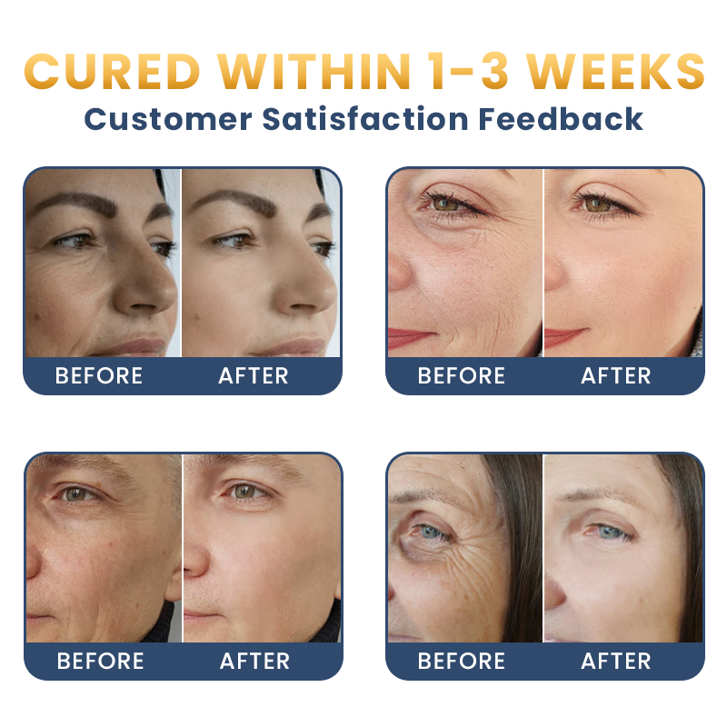 LIMETOW® Anti-Wrinkle Moisturizing Cream