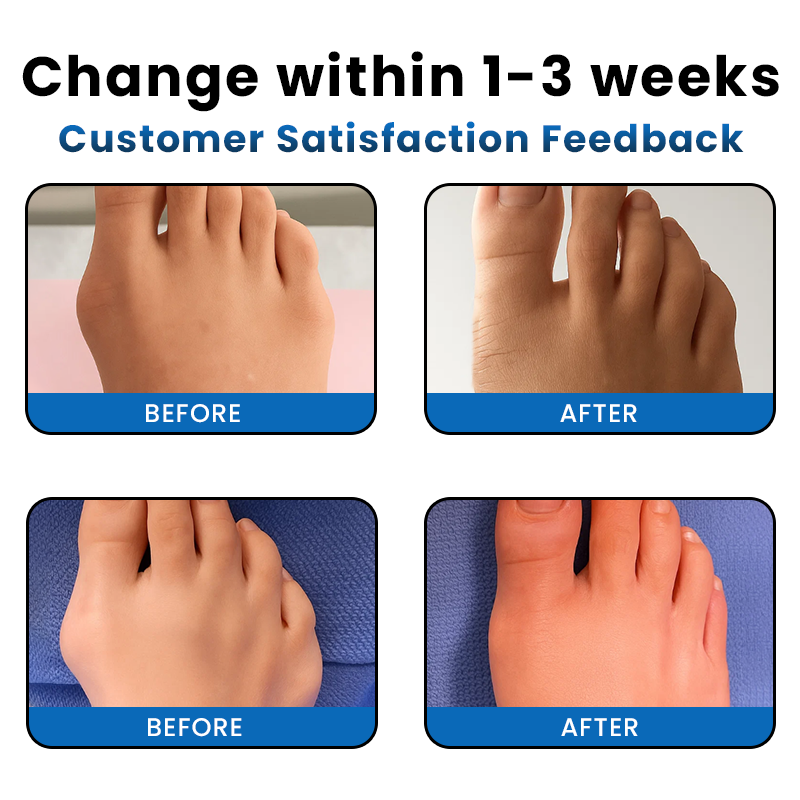 LIMETOW® Bunion-Free Solution