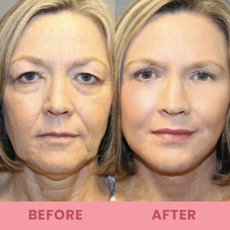 đĽLimited Time Offerâ°LIMETOW⢠Compact Anti-wrinkle Bar