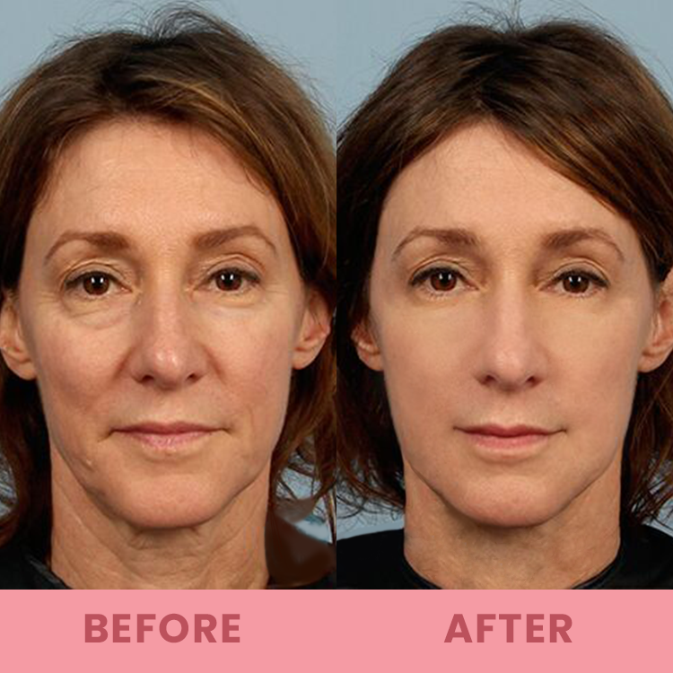 đĽLimited Time Offerâ°LIMETOW⢠Compact Anti-wrinkle Bar
