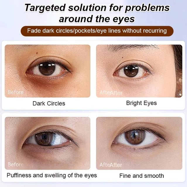 LIMETOW®Anti-wrinkle eye serum oil