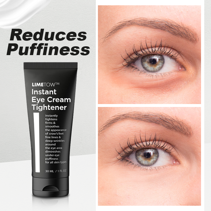 LIMETOW™ Instant Eye Cream Tightener