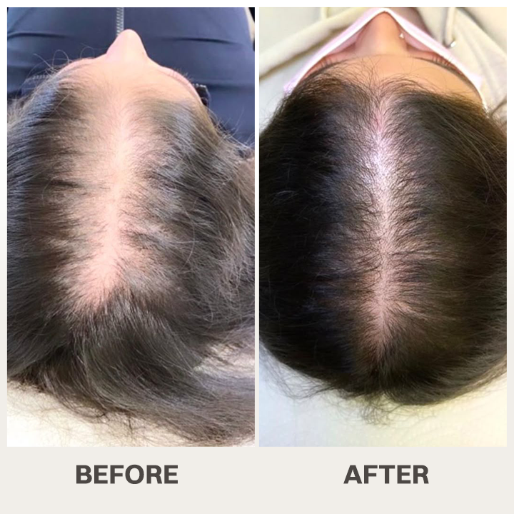 LIMETOW® Scalpy Hair Serum — The Scalp-First Hair Growth Breakthrough