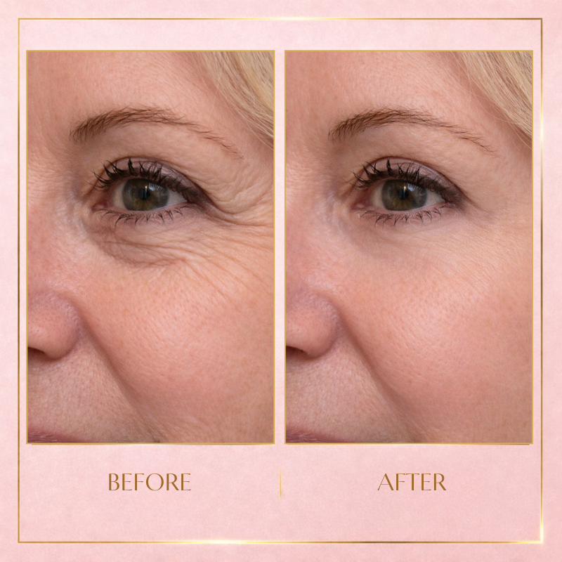 Instant Line Filler | Smooths the Look of Fine Lines in Seconds