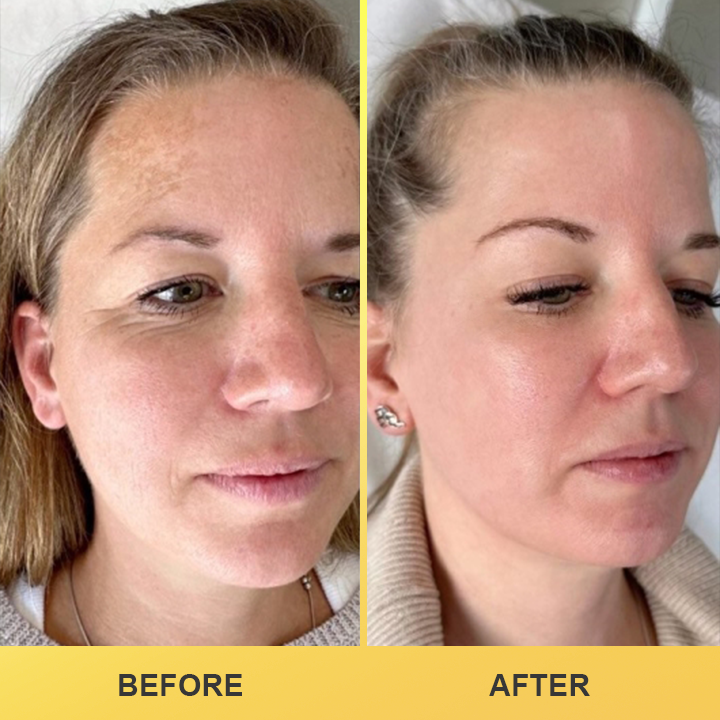 LIMETOW® Revive Eye Cream
