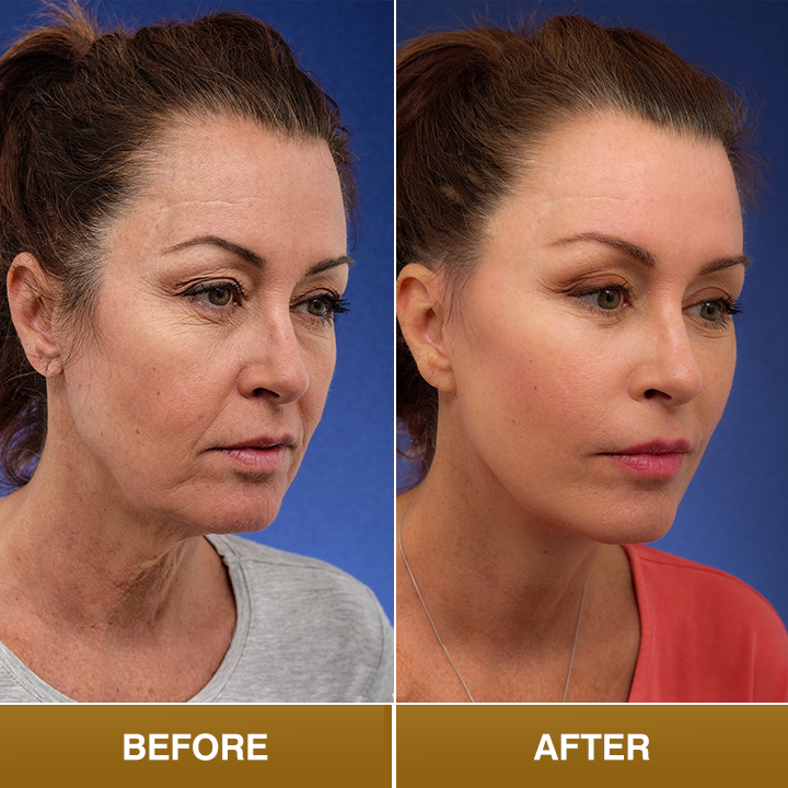 LIMETOW® Polypeptide Collagen Elastic Essence Cream