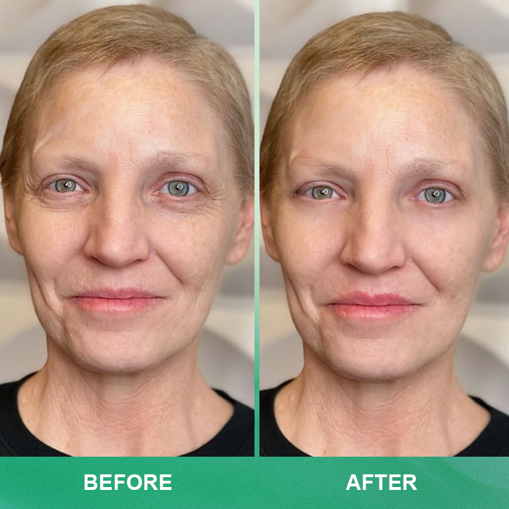 ⏰Limited Time Offer⏰LIMETOW™ Anti-wrinkle Cream Stick
