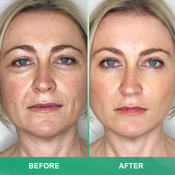⏰Limited Time Offer⏰LIMETOW™ Anti-wrinkle Cream Stick