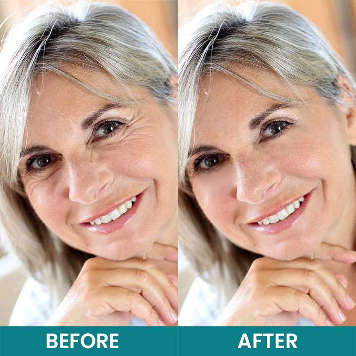LIMETOW®Dual Action Real Deep Collagen Sheets for both wrinkle smoothing and new or old scar fading