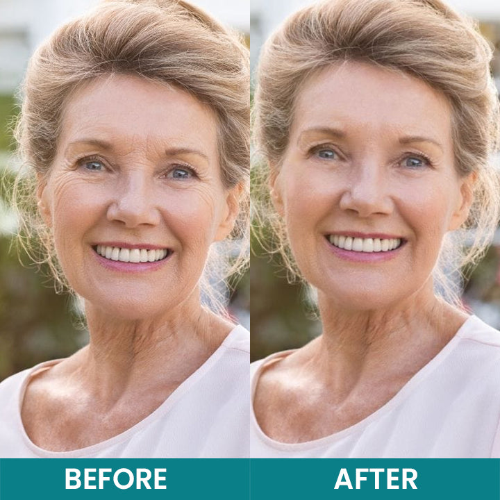 LIMETOW®Dual Action Real Deep Collagen Sheets for both wrinkle smoothing and new or old scar fading