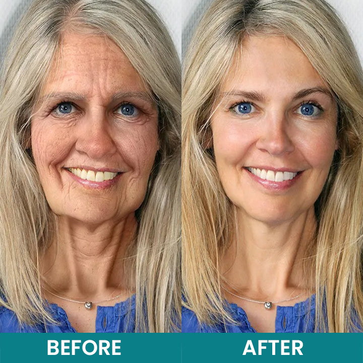 LIMETOW®Dual Action Real Deep Collagen Sheets for both wrinkle smoothing and new or old scar fading