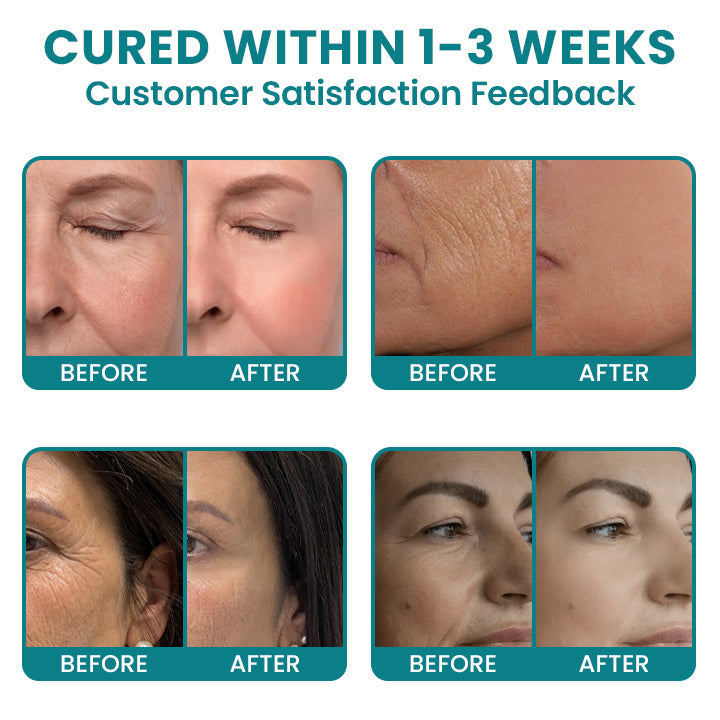 LIMETOW®Dual Action Real Deep Collagen Sheets for both wrinkle smoothing and new or old scar fading