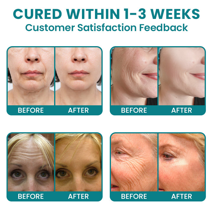 LIMETOW®Dual Action Real Deep Collagen Sheets for both wrinkle smoothing and new or old scar fading