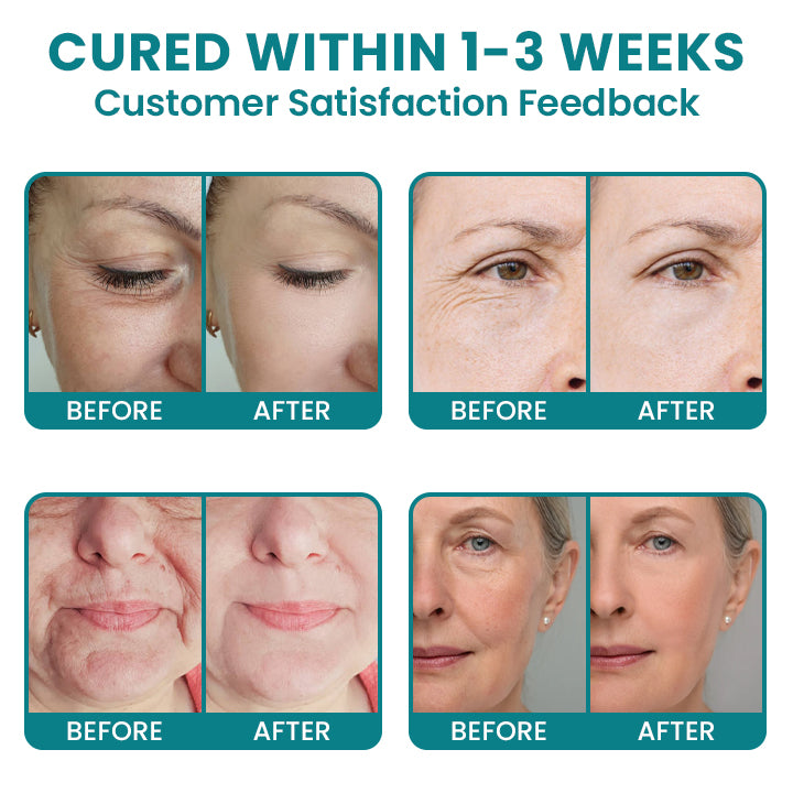 LIMETOW®Dual Action Real Deep Collagen Sheets for both wrinkle smoothing and new or old scar fading