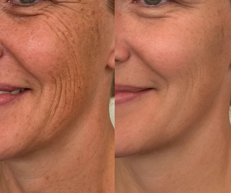 LIMETOW®Dual Action Real Deep Collagen Sheets for both wrinkle smoothing and new or old scar fading