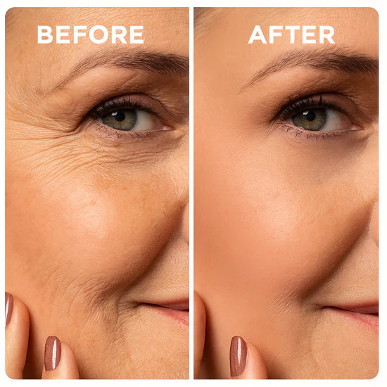 LIMETOW®Dual Action Real Deep Collagen Sheets for both wrinkle smoothing and new or old scar fading