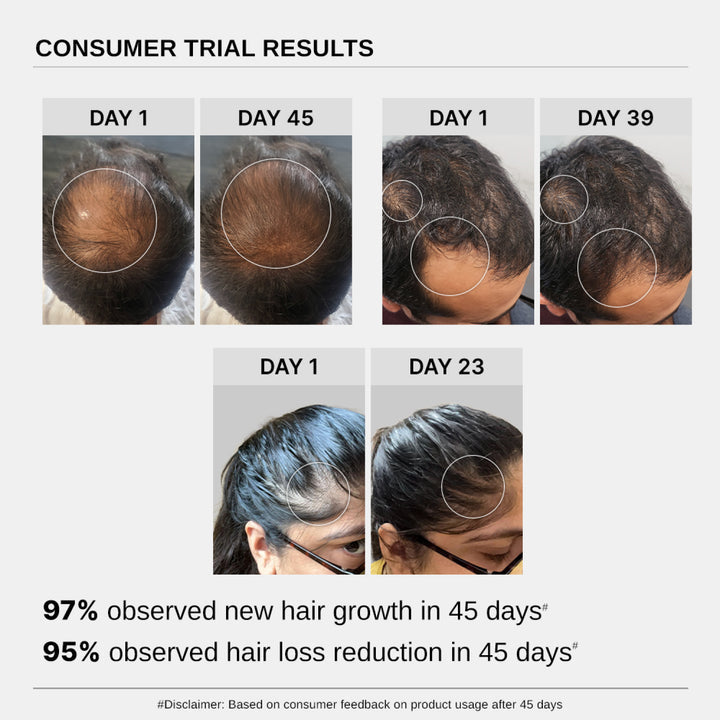 LIMETOW® Hair Growth Serum