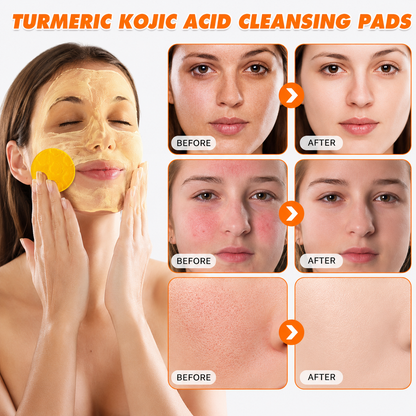 Turmeric Kojic Glow Pads
