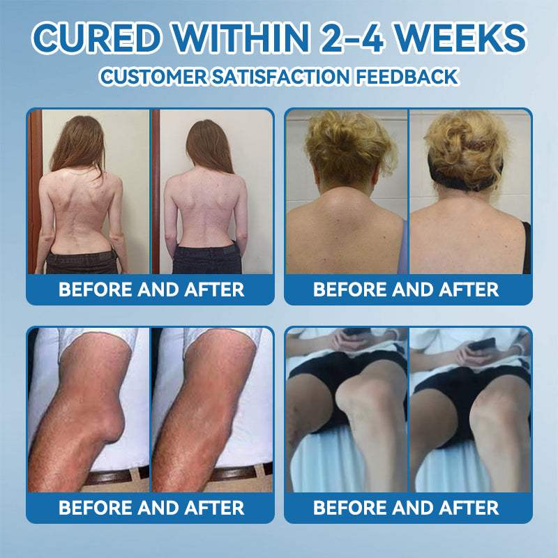 | 𝐋𝐚𝐬𝐭 𝐃𝐚𝐲 𝐏𝐫𝐨𝐦𝐨𝐭𝐢𝐨𝐧 𝟖𝟎% 𝐎𝐅𝐅 |LIMETOW® ʙ.ᴘ.ᴄ-157 Joint Healing Cream🦴Treats Arthritis, Neuropathy, Rheumatism, Sports Injuries & More🌸🌸