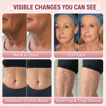 MREVBSIN®🌸 Botox-Inspired Pure Collagen Firming Wand — Needle-Free Fine Line Smoothing, Firming & Plumping Skincare Balm