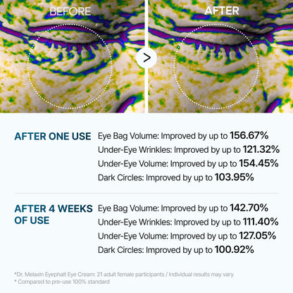 Dr. Melaxin Eyebag Cream💖LAST DAY SALE - 50% OFF