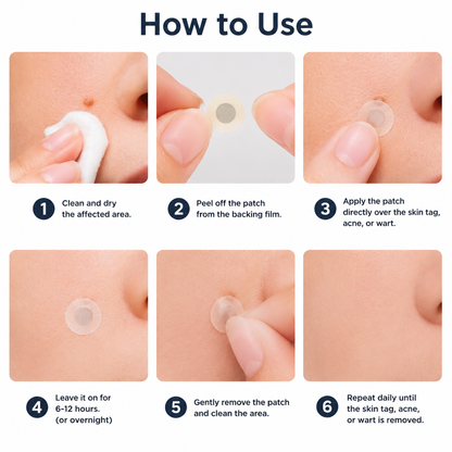 LIMETOW® 2-in-1 Microneedle & Hydrocolloid Patch🍀 | Removes Raised Moles, Acne, Flat Warts, Skin Tags, Milia & Age Spots | No Surgery Needed | Invisible Skin Treatment for Face & Body | 90-Day Money-Back Guarantee