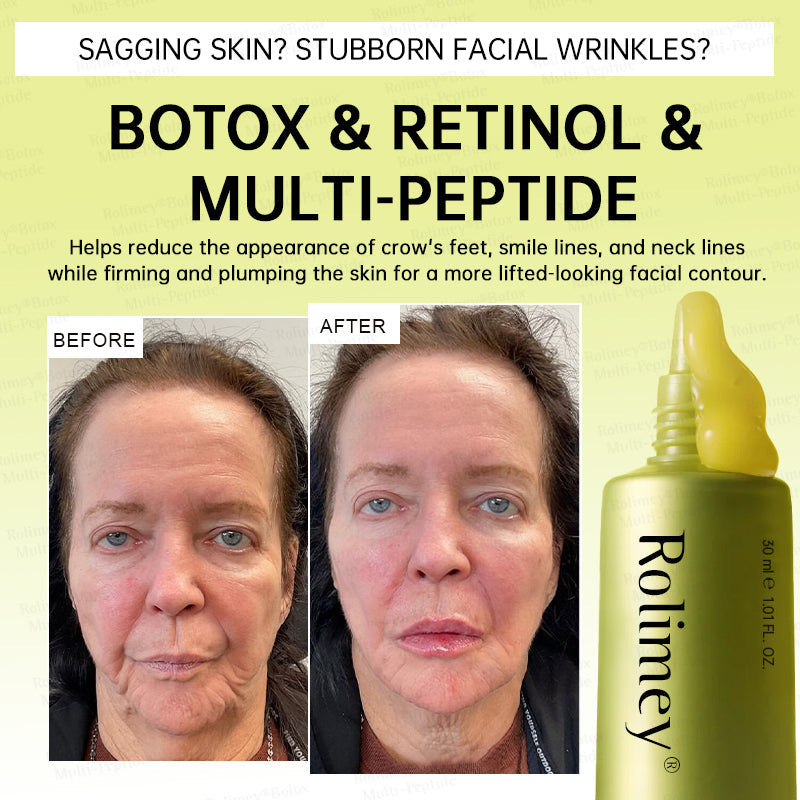 🏅💧💐Rolimey® Multi-Peptide Retinol Shot Wrinkle-Lift Cream