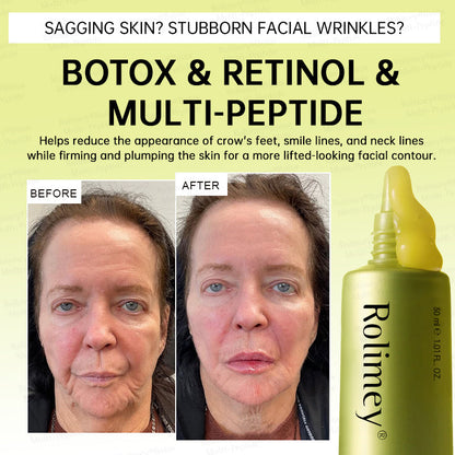 🏅💧💐Rolimey® Multi-Peptide Retinol Shot Wrinkle-Lift Cream