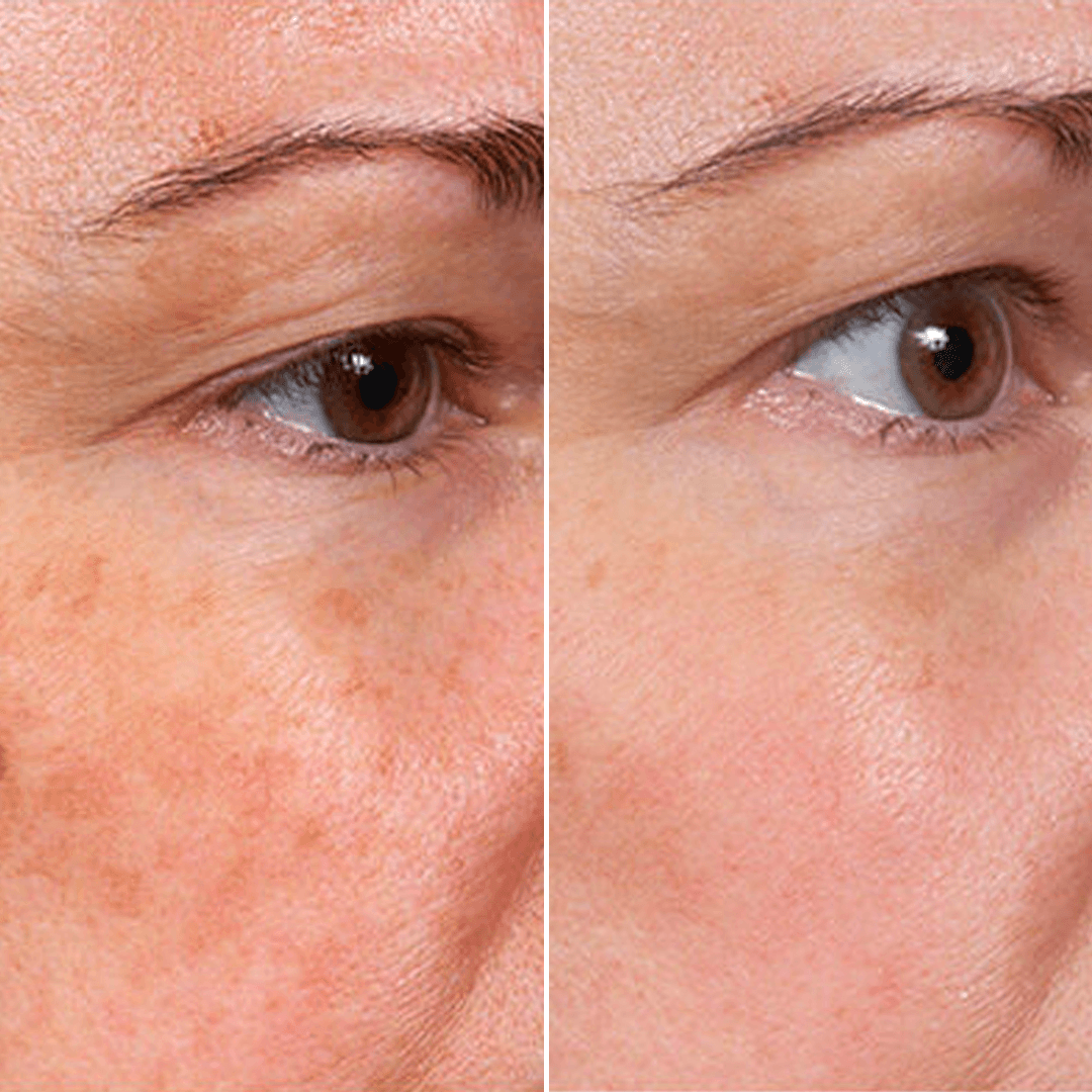 LIMETOW® Rejuvenate Face Serum