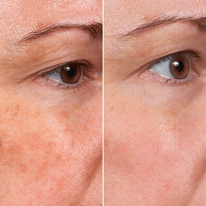 LIMETOW® Rejuvenate Face Serum