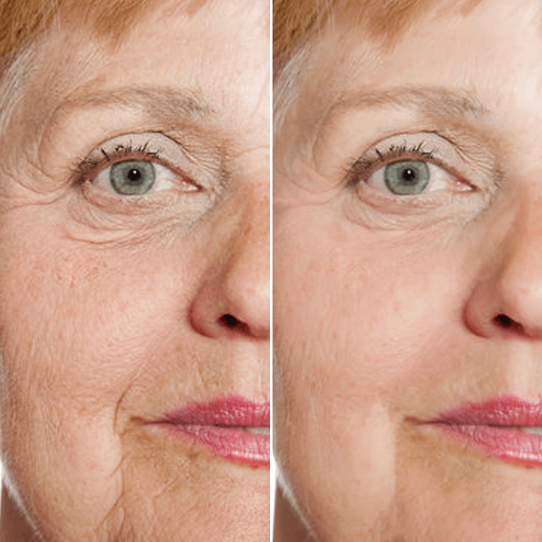LIMETOW® Rejuvenate Face Serum