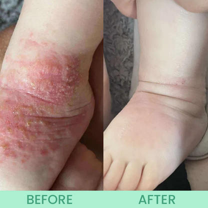 LIMETOW® Calm Balm