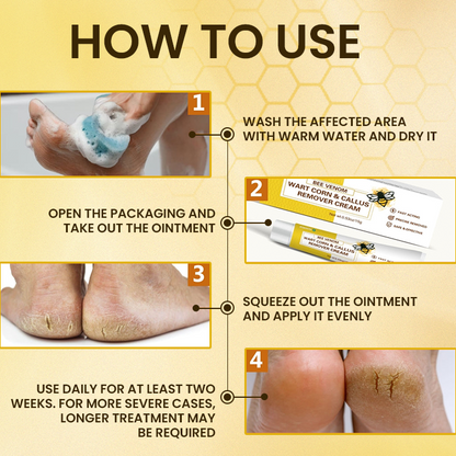 LIMETOW® Bee Venom Corn & Callus Remover Cream