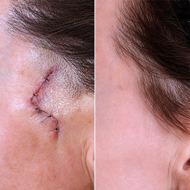 LIMETOW® Advanced Silicone Smoothing Gel