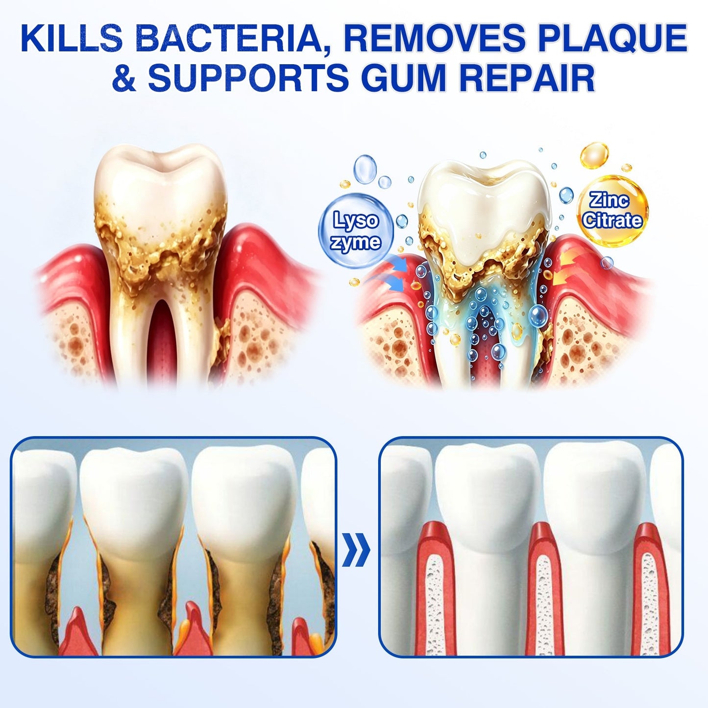 Gum Revive Periodontal Repair Gel