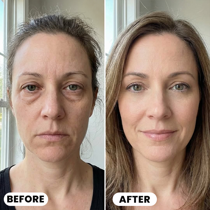 LIMETOW® Ultimate Depuff Eye Serum⚡Limited-Time Offer