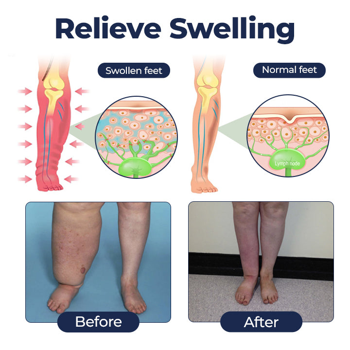 Swell Relief Circulation Support Cream🎁2026 Best Seller