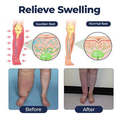 Swell Relief Circulation Support Cream🎁2026 Best Seller