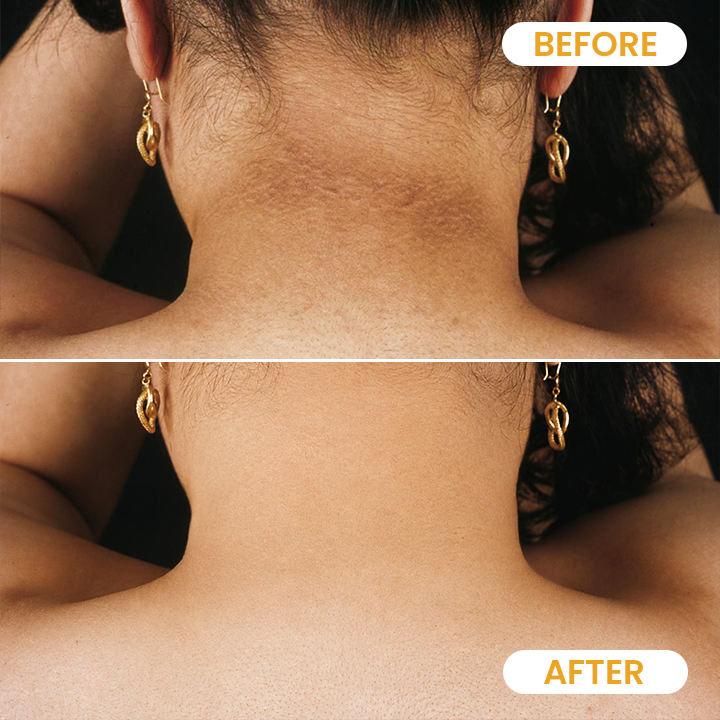 LIMETOW® Turmeric Exfoliating Body Scrub