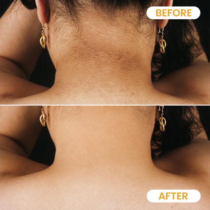 LIMETOW® Turmeric Exfoliating Body Scrub