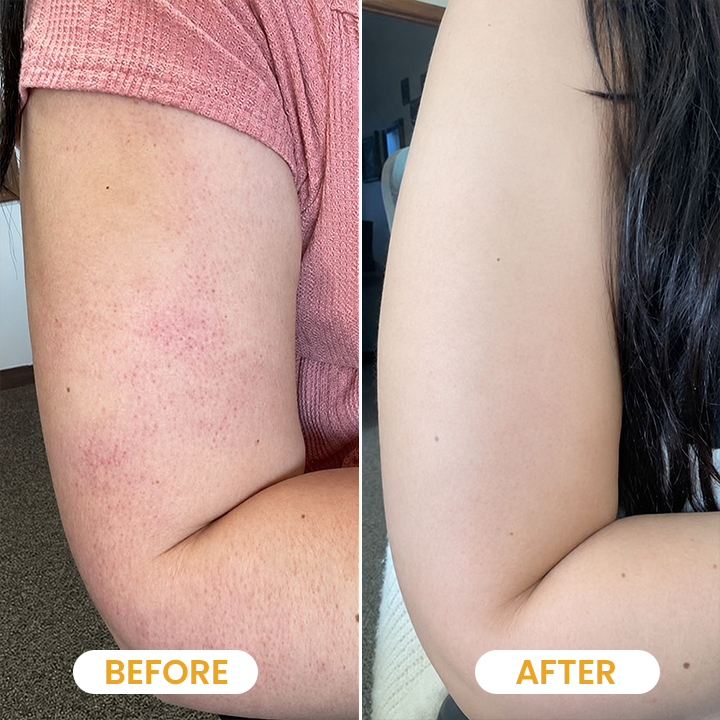 LIMETOW® Turmeric Exfoliating Body Scrub